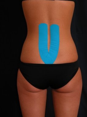 Lage rug tapen Fysio Masters