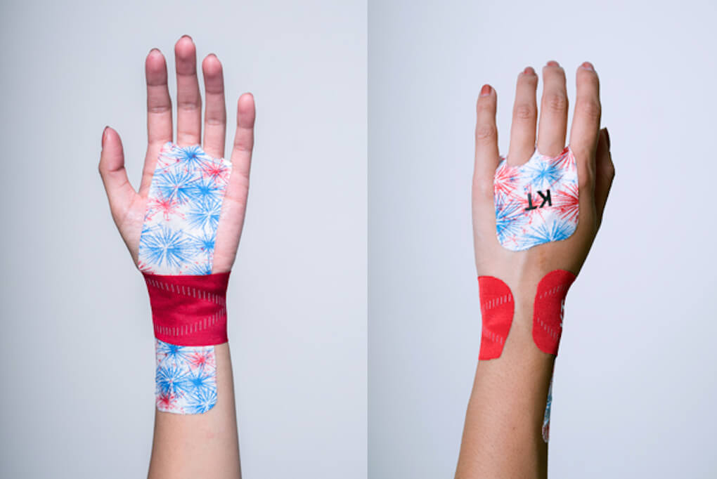 Тейпирование лучезапястного сустава схема