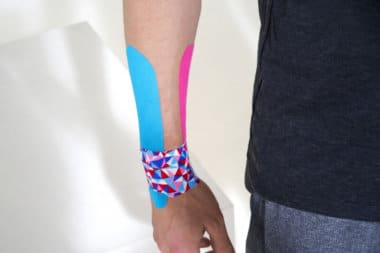 verstuikte pols intapen